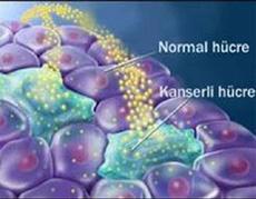 Kanser